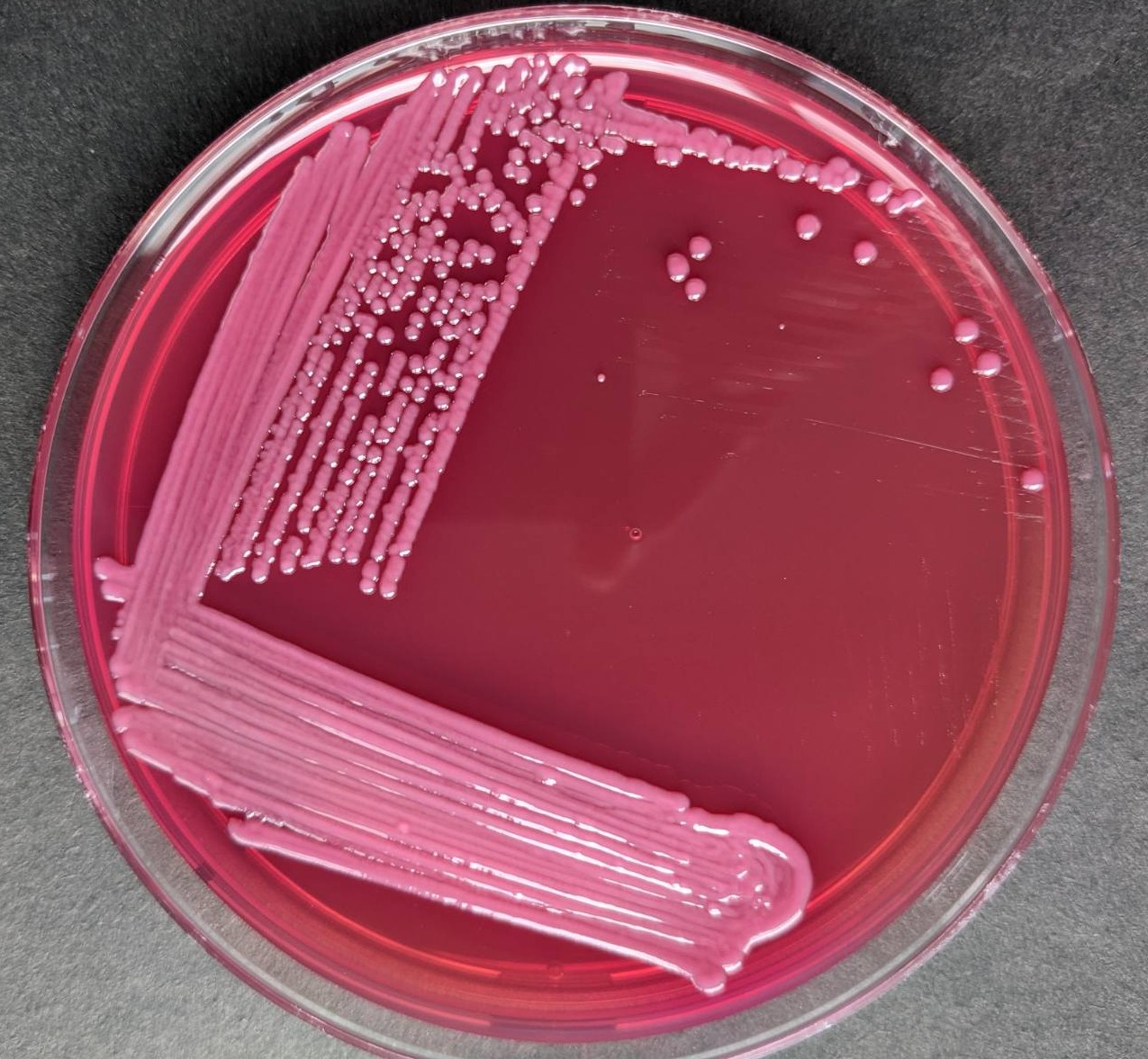 images Shigella Spp On Macconkey Agar microbe online