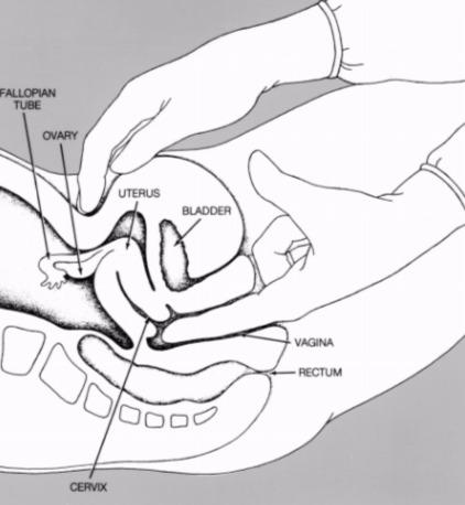 cpt code 76856 76857 and 76830 pelvic ultrasound coding on well woman exam cpt