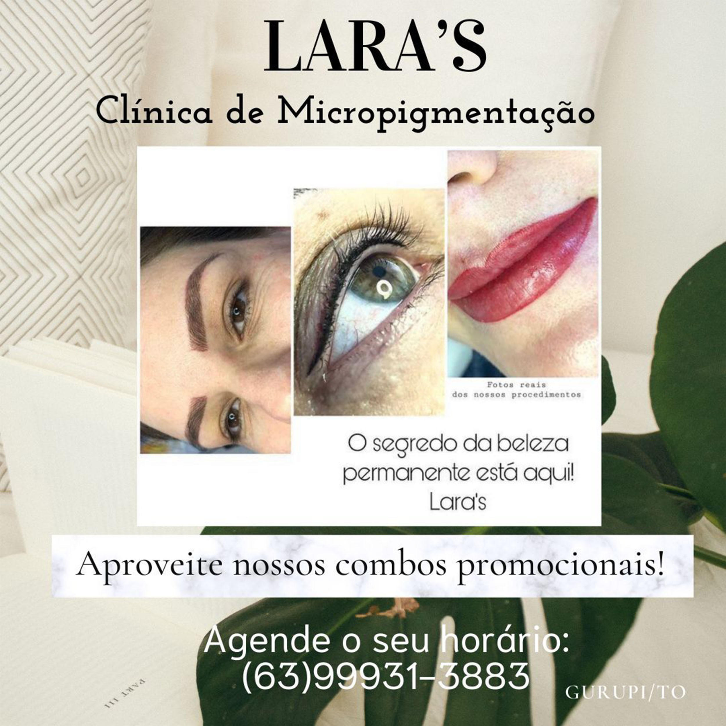 LARAS1