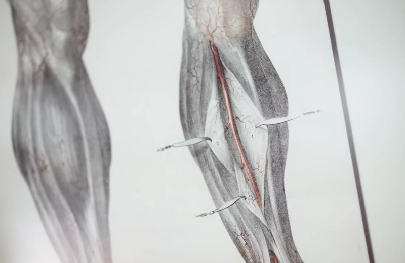 Hamstring Strain Recovery Time: How Long Healing Really Takes 1 Hamstring Muscle Anatomy - icare Physical Therapy And Wellness