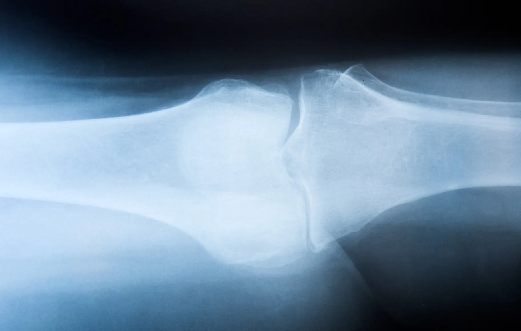 knee scan