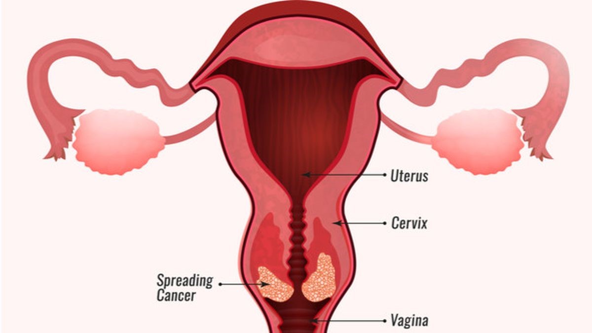 Indonesia Cancer Care Munity Iccc Tes yang disebut paternity test ini memiliki banyak peminat.