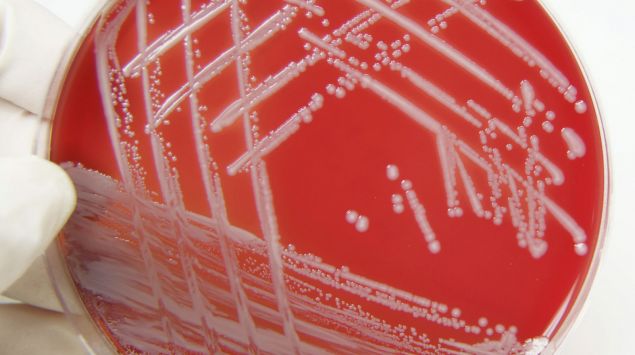 11+ Nice Mrsa Zu Hause : Das Online-Magazin fÃ¼r die Pflege zu Hause | AngehÃ¶rige / Sie können individuelle flyer außerdem hier öffnen oder downloaden: