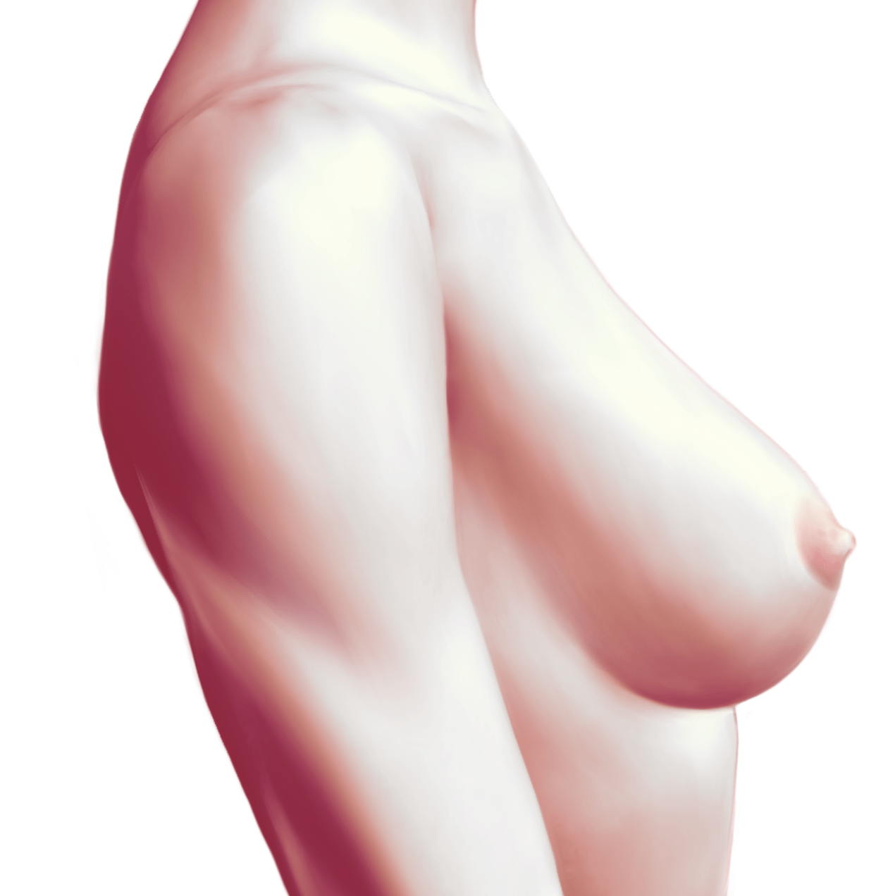 Chirurgie de revizie din cauza asimetriei