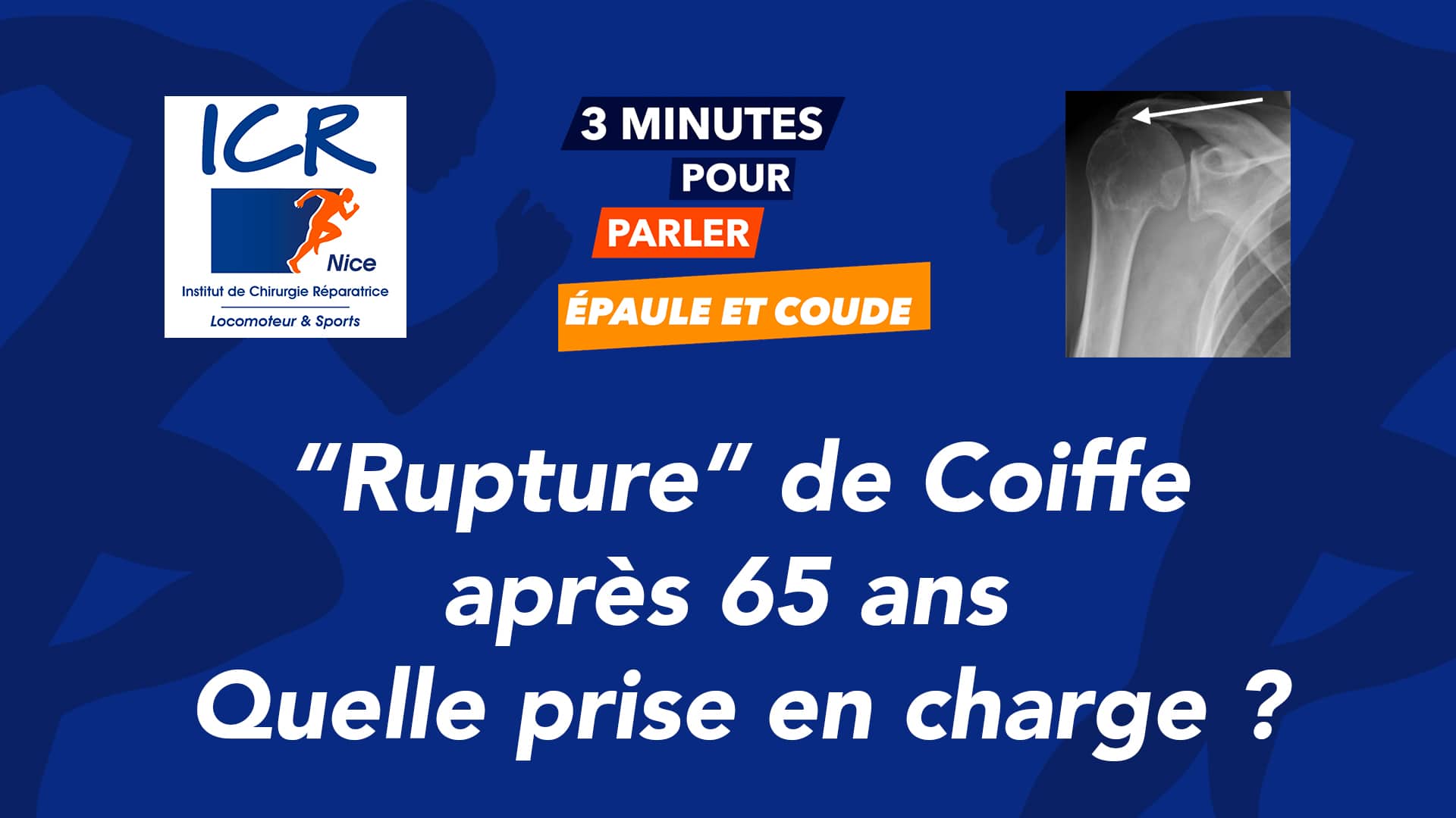 Rupture de coiffe après 65 ans