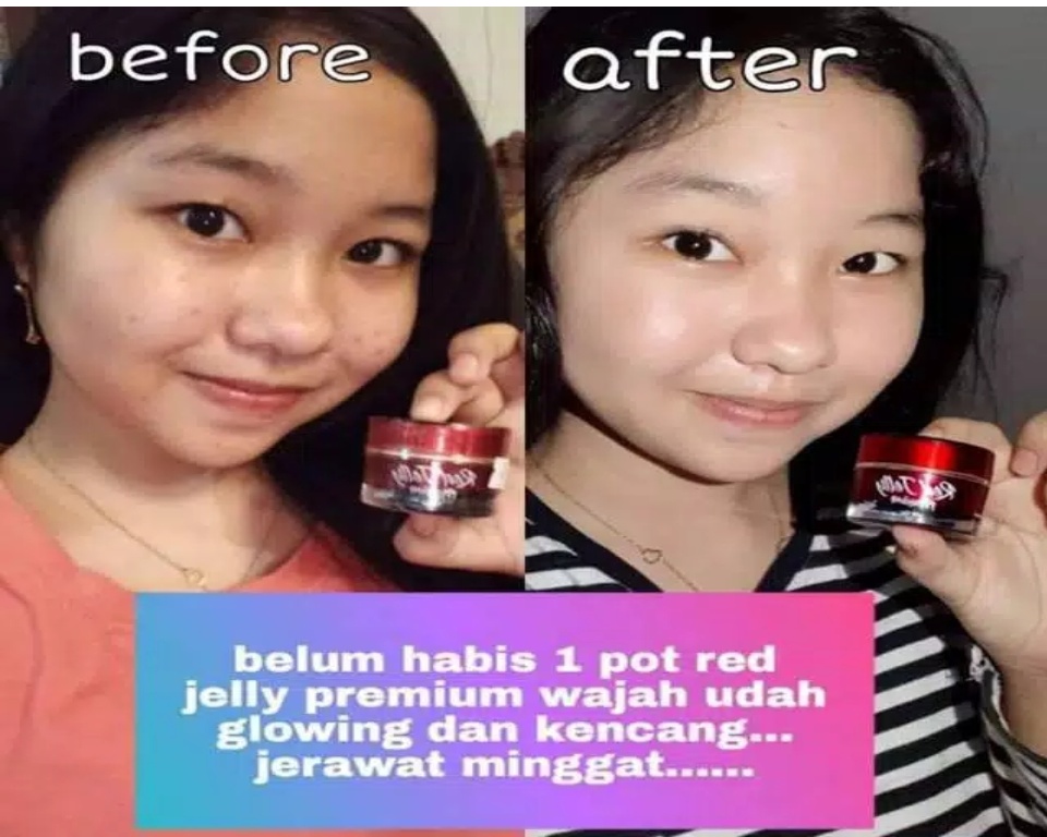 Sementara produk red jelly ms glow palsu . Bayar Ditempat Red Jelly Premium Skin Booster Rk Glow Original Aman Halal Dan Bpom Membuat Wajah Putih Glowing Dan Meremajakan Kulit Wajah 100 Original Berid Card Lazada Indonesia