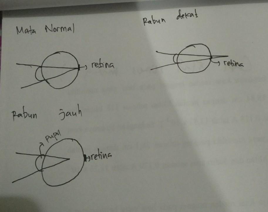 Jadi, untuk mata miopi dapat ditolong dengan kacamata berlensa cekung (negatif). Seorang Kakek Harus Memakai Kacamata Saat Membaca Koran Seperti Tampak Pada Gambar Kakek Brainly Co Id