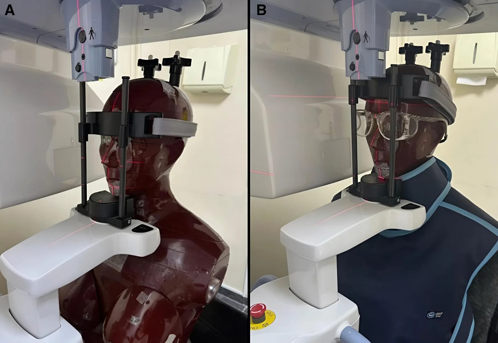 Two CBCT setup photographs showing a head phantom positioned in the scanner without shielding and with lead protective gear for comparison.