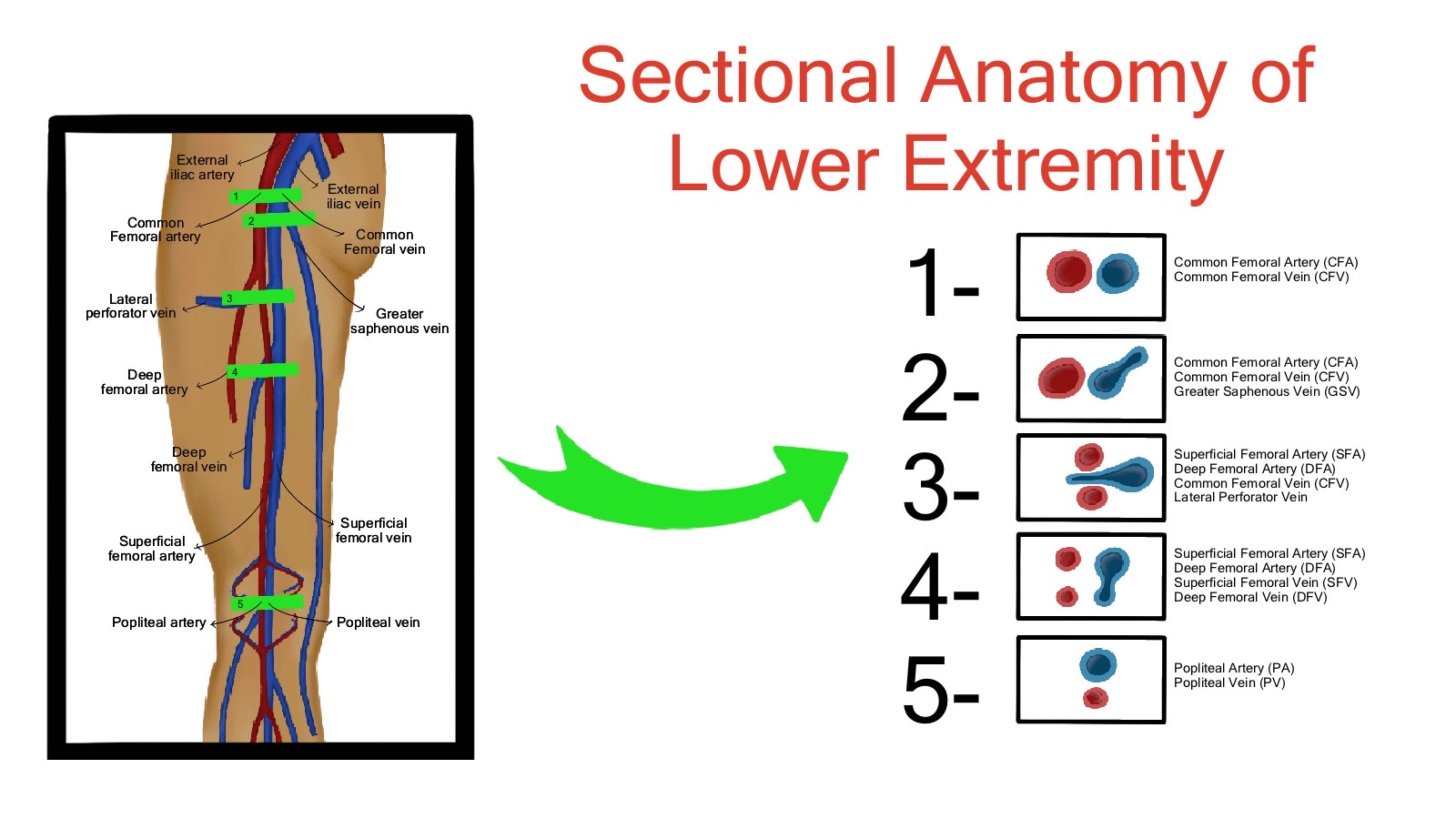 Lower Extremity Deep Venous US Imaging Illustrations International