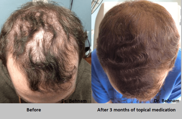 Garantiert kein stress testosteron muskelaufbau