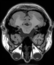 Ij Plugins Connected Threshold Growing Example - Beautiful Ultra HD Nature Illustrations | Free Download