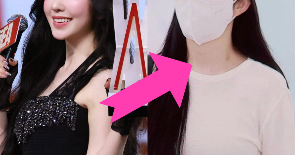 Red Velvet's Irene Sparks Dating Rumors: Hickey or Just a Mark? (2026)