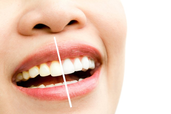 A woman with a cheerful expression, her white teeth visible, conveying warmth and friendliness through her smile.