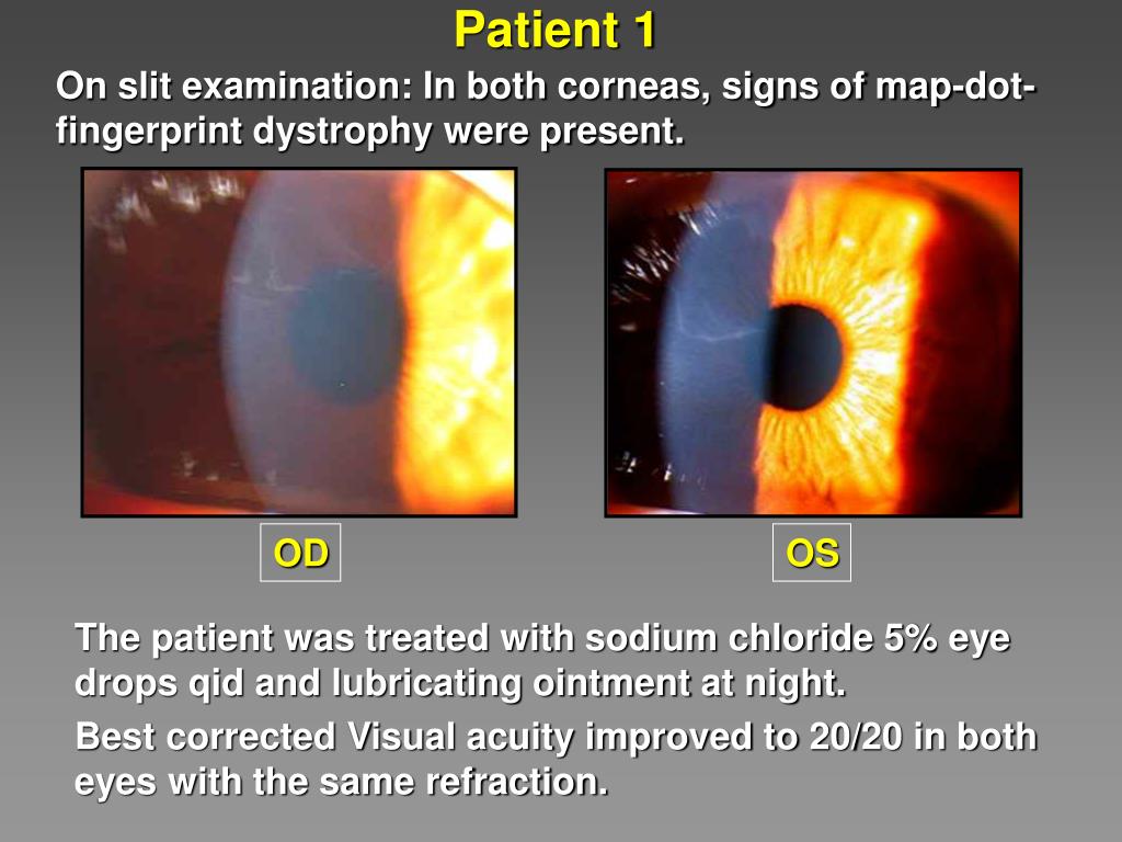 Fingerprint Dystrophy Definition At Lea Blackburn Blog Slide5 L 
