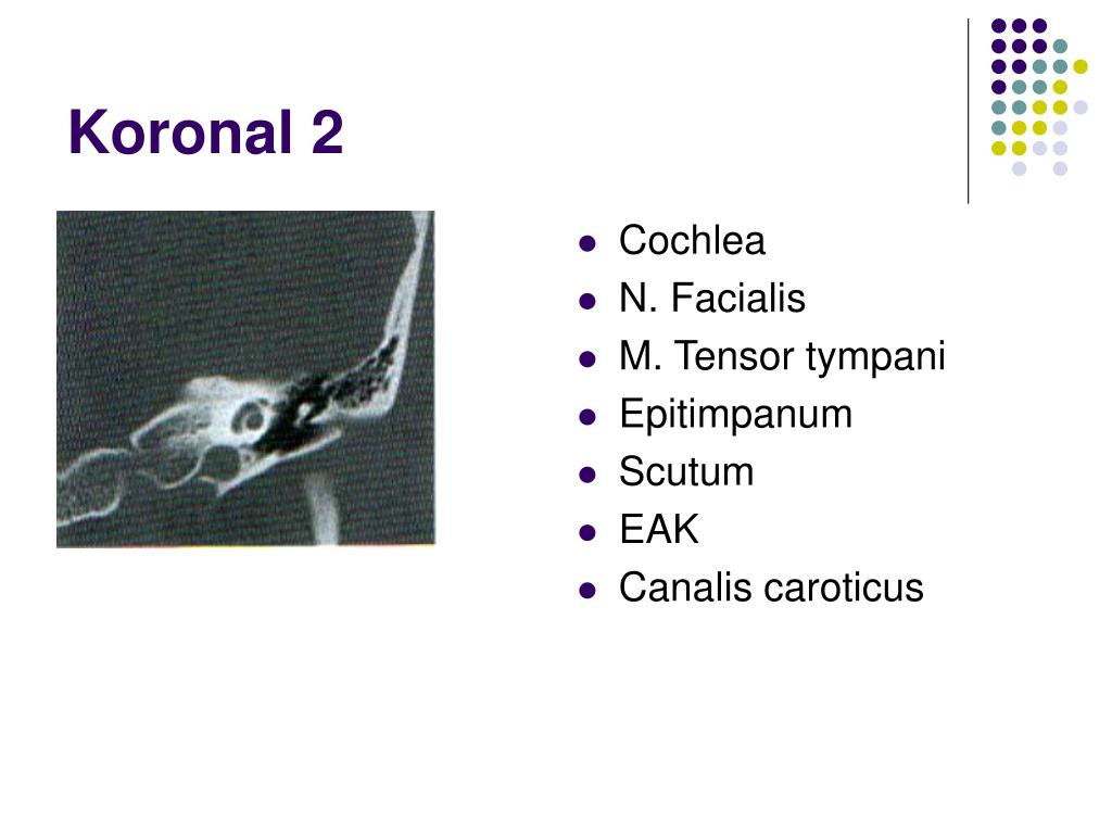 Canalis Caroticus Hangi Kemikte / Canalis Caroticus Nedir