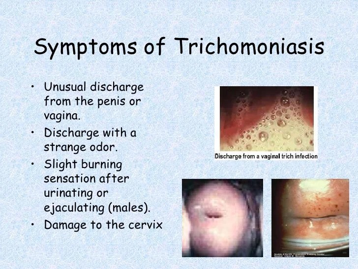 wallpapers Trichomoniasis Sores In Men slideshare