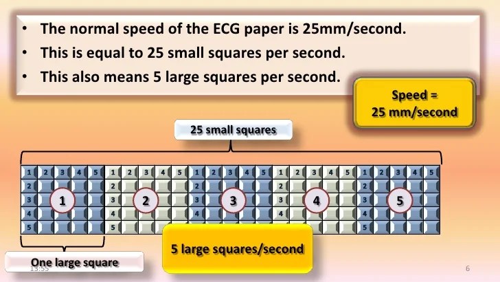 ecg reading