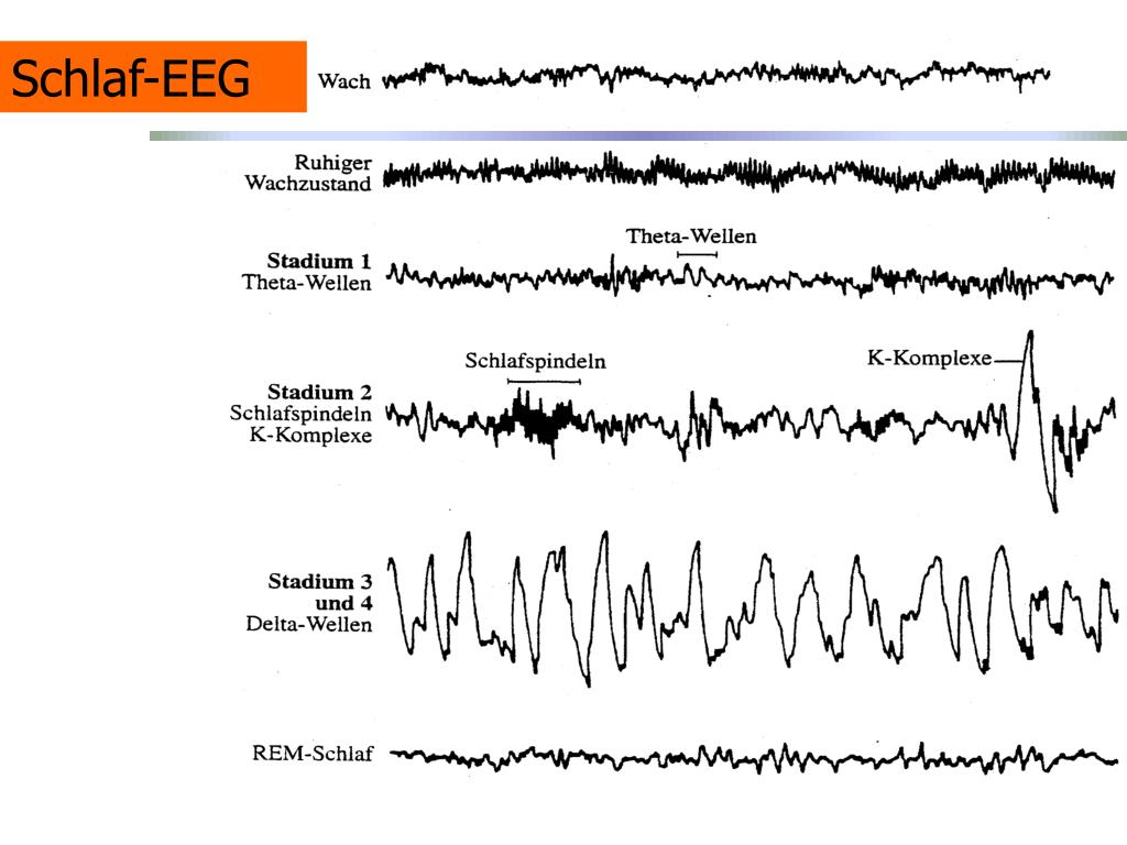 Nach etwa 15 minuten beginnt der eigentliche schlaf, der zunehmend tiefer wird. PPT - SchlafstÃ¶rungen und ErschÃ¶pfung PowerPoint