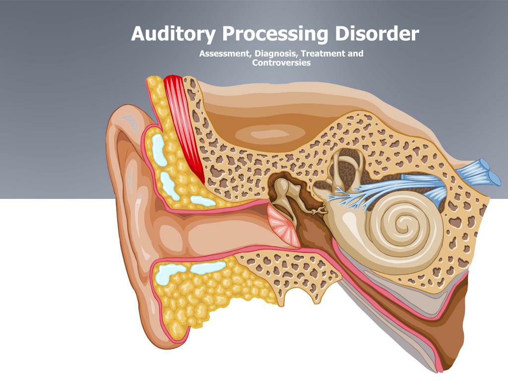 H54.8 is a billable diagnosis code used to specify a medical diagnosis of legal blindness, as defined in usa. PPT - Auditory Processing Disorder PowerPoint Presentation