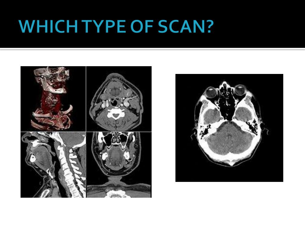 PPT - BIOLOGICAL BASES OF BEHAVIOR: THE BRAIN PowerPoint ...