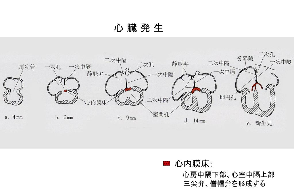 心臓弁膜癥 心臓弁膜癥 しんぞうべんまくしょう 臓が入る熟語 Yihbk