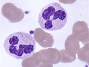 Neutrophils
