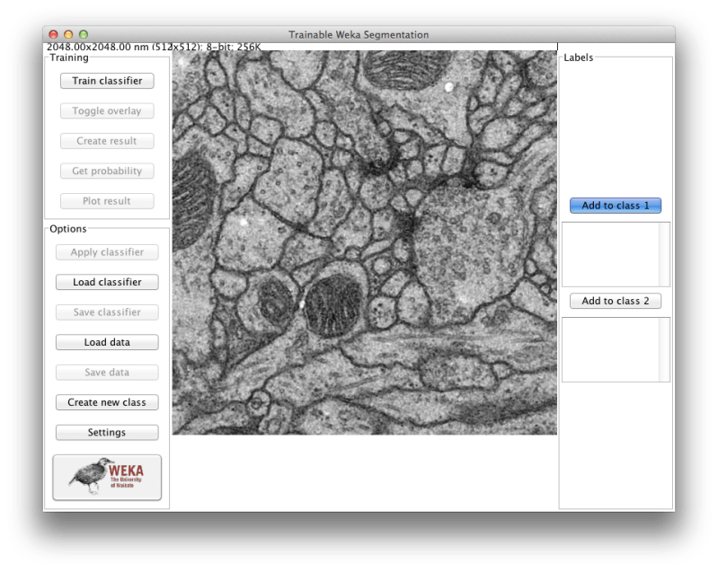 Github Odinsbane Jfilament Active Countour Based Segmentation Fiji - City Illustration Collection - 4K Quality