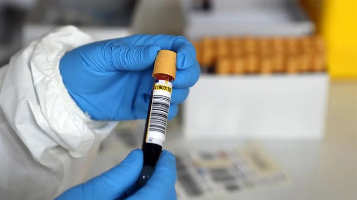 Septiembre es un mes de fiestas para los mexicanos, es por ello que el gobierno mexicano ha decidido celebrar el próximo 21 de septiembre —que . Las pruebas PCR de coronavirus se harÃ¡n en las primeras 24