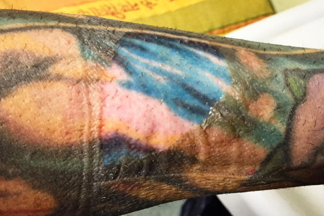 Camadas da pele derme tatuagem Como Funciona Uma Maquina De Tatuagem Super