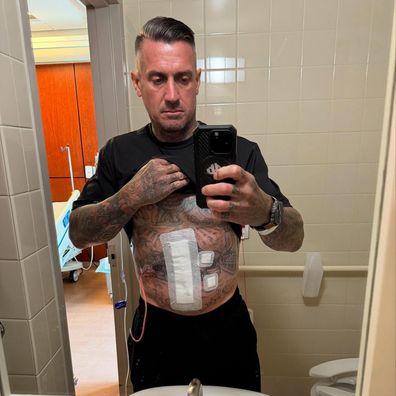 Carey Hart shares he is back in hospital after another biking accident
