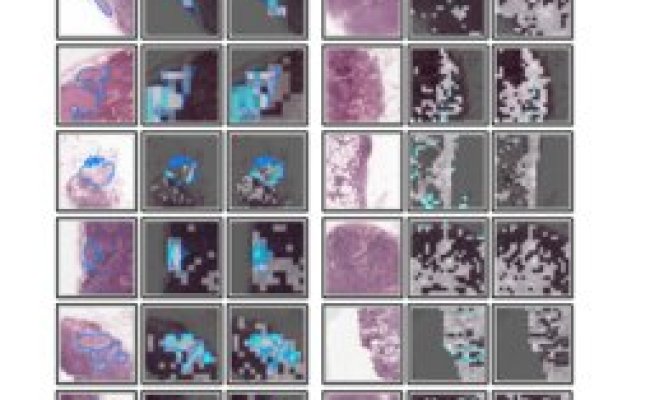 Multiple Instance Learning Framework With Masked Hard Instance Mining ...