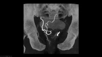 Philips Smartct Soft Tissue Imaging Technology - Premium Geometric Photo Gallery - 8K