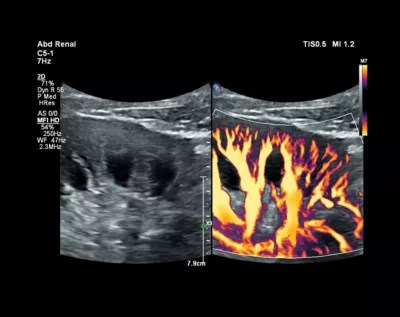 Microflow Imaging Products Services Philips - Landscape Background Collection - 8K Quality