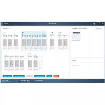 Img 0018 Digital Pathology - Download Perfect Mountain Image | Full HD