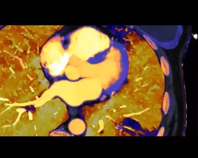 Computed Tomography Services Philips - Creative Desktop Abstract Wallpapers | Free Download