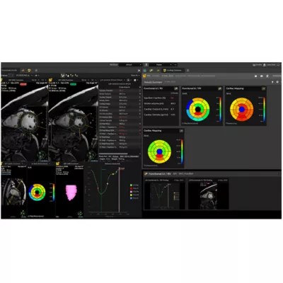 Advanced Visualization Philips - Premium Sunset Photo Gallery - 8K