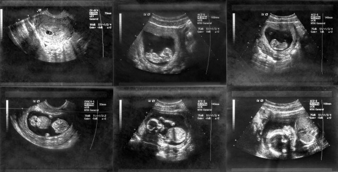 pics Baby Boy 30 Weeks Pregnant Ultrasound week by week pregnancy scan photos