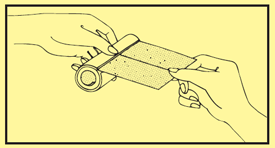 Cordran tape (flurandrenolide tape): side effects, uses, dosage, interactions, warnings