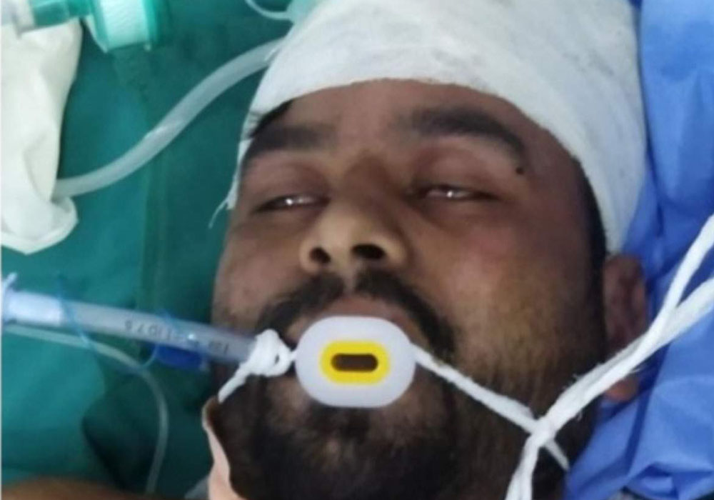 The hands of the young man cut by sarpanch's husband - Vimarsana News