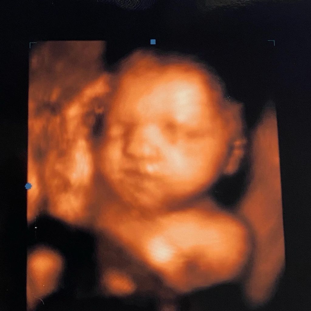 30 week 3d ultrasound