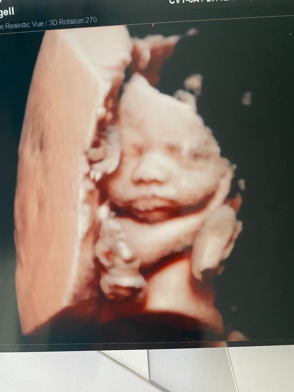 30 weeks 3d ultrasound