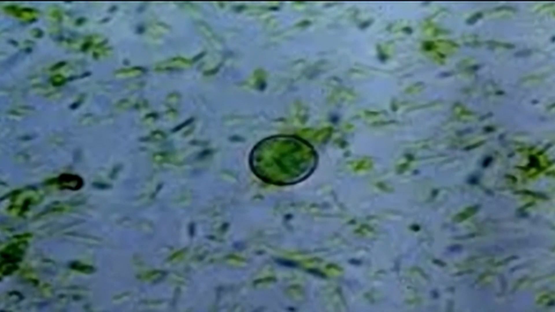 Cyclospora Outbreak in North Carolina: What You Need to Know (2026)