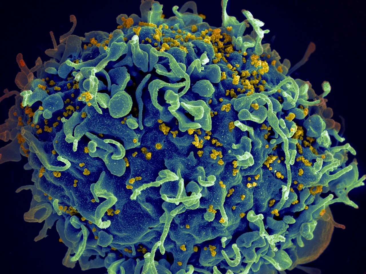 Human immunodeficiency virus, more commonly known as hiv, is a virus that, without treatment, leads to deterioration of your body’s immune system to a point where your body has trouble fighting off mild infections. Ph9e9epvobkrrm
