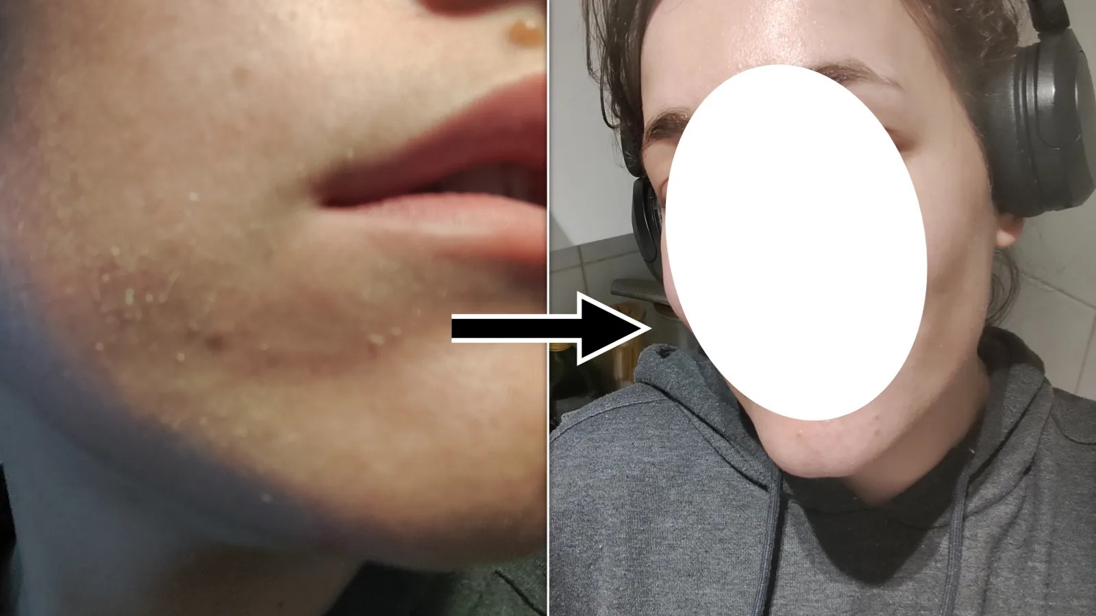 I Tried 'Wine For Your Skin' ― Here's What Happened To My Face