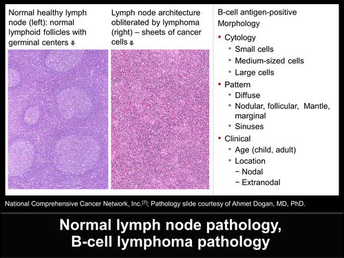 Alcatel one cells and b labeled lymph slide node t vibe shot xperia