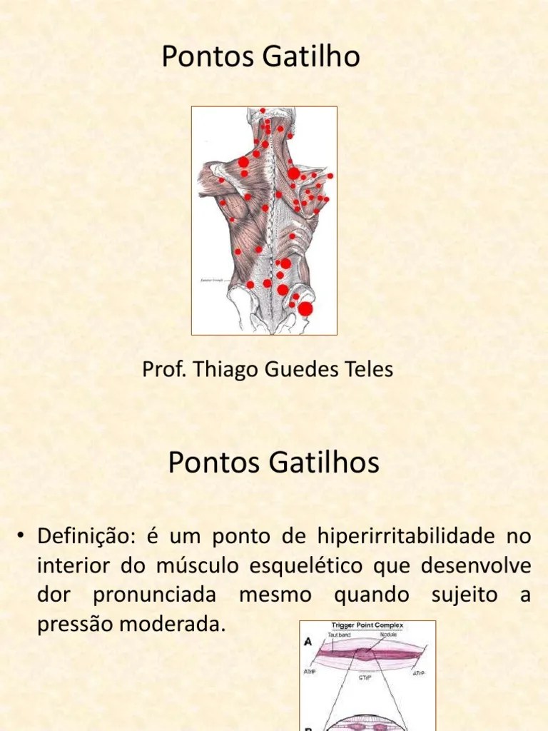 Pontos Gatilhos | PDF | Músculo | Dor