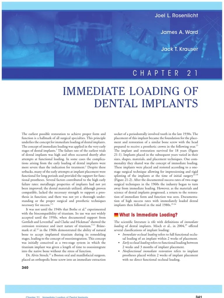 Immediate Loading Of Dental Implants PDF | PDF | Dental Implant ...