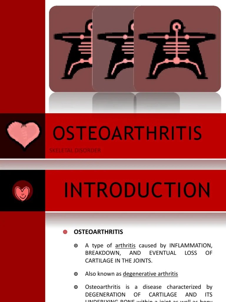 OSTEOARTHRITIS | PDF | Osteoarthritis | Cartilage