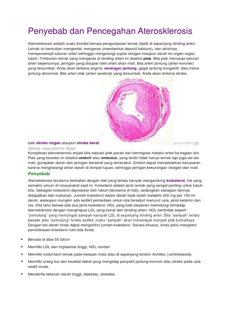 Penyebab Dan Pencegahan Aterosklerosis
