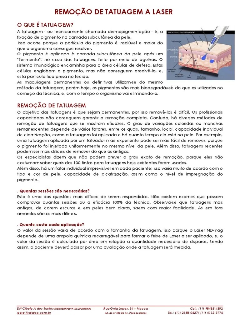 Manual Remocao Tatuagem | Download Grátis PDF | Tatuagem | Pigmento